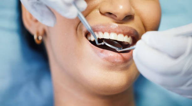 Best Same-Day Emergency Dentist in Calico Rock, AR